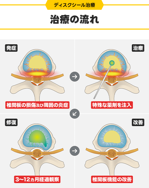 治療の流れ