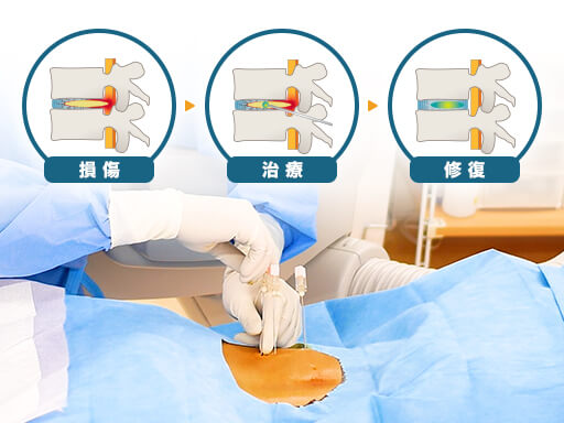 椎間板ヘルニア・脊柱管狭窄症・すべり症などの幅広い腰痛に対応