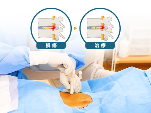 椎間板ヘルニア・脊柱管狭窄症・すべり症などの幅広い腰痛に対応